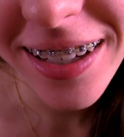 Innocent Teen Wants Your Load On Her Braces